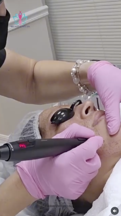 RN Laser & Med Spa reel