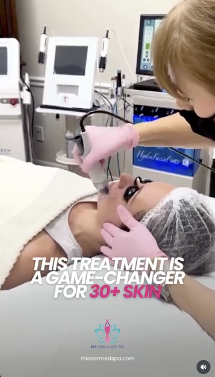 RN Laser & Med Spa reel